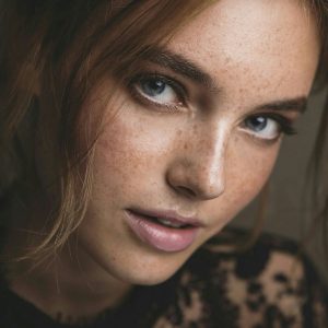 Soleil et Peau ☀️ Chloé - rencontre-Teen-Quimper